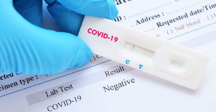 Coronavirus-Test